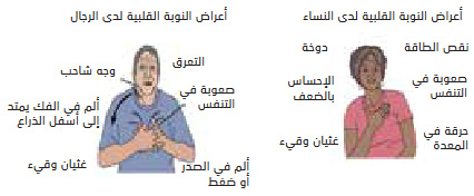 Heart Attack